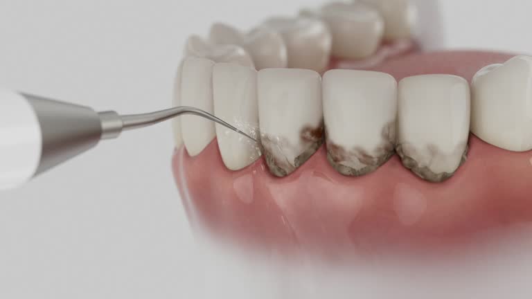 Trusted Teeth Cleaning And Checkup service in Akron, IN - Dentist Open Now